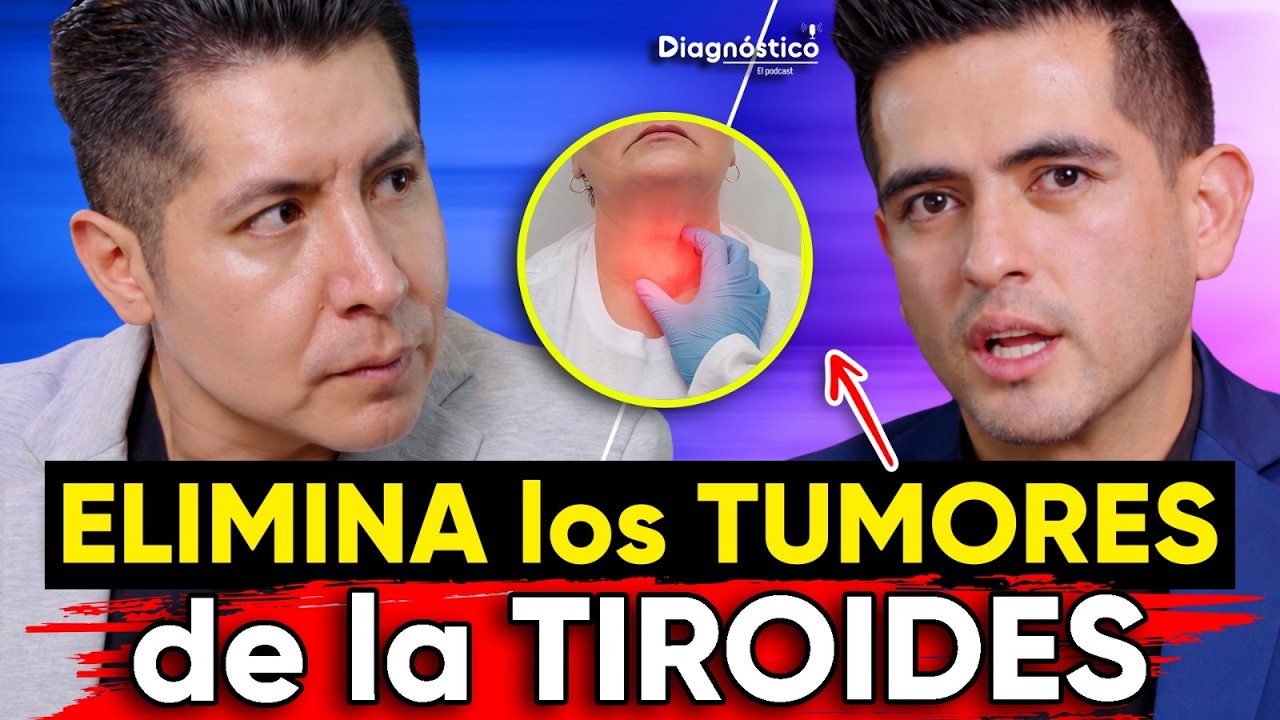 ⚠️NÓDULOS TIROIDEOS podrían ser C4NCER: Cómo ELIMINARLOS | #Diagnóstico 200 | Mr Doctor