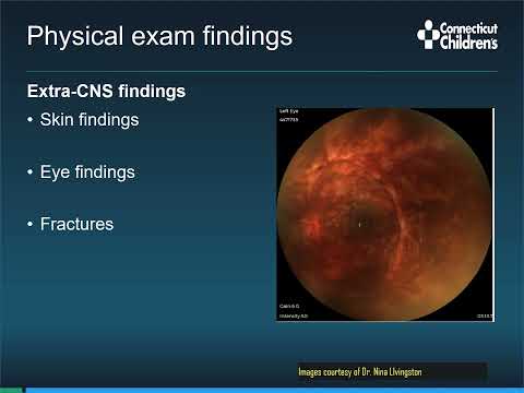CNS Neurosurgery 100: Abusive Head Trauma