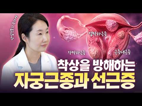 자궁근종 있으면 임신 안 될까? 수술을 고려한다면 무조건 시청!