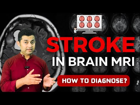 Decoding MRI Sequences: How to Identify Stroke in Brain Imaging Like a Pro
