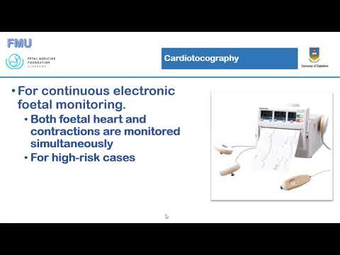 Electronic Fetal Monitoring (CTG Part 1)