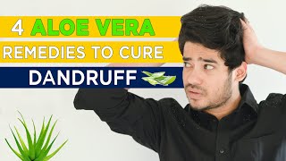 4 Aloe Vera Remedies to Cure Dandruff | Man Matters