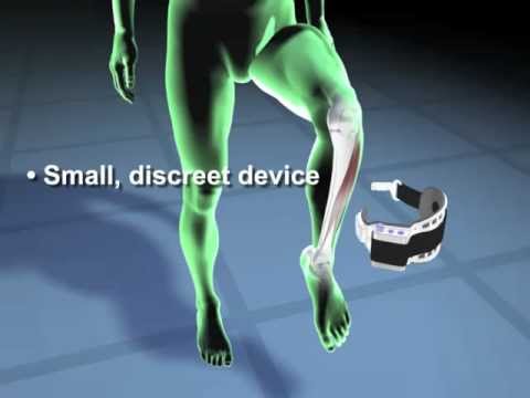 The WalkAide System - Image 2