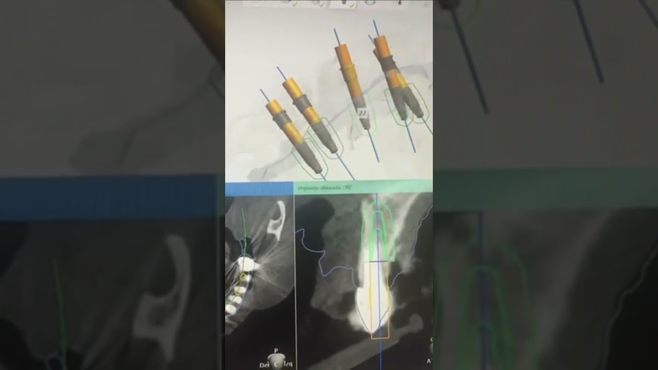 Cristian Hernandez Ossa-12