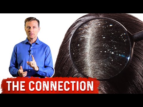 Maximizing Gut Health Optimal Timing for Probiotic Intake