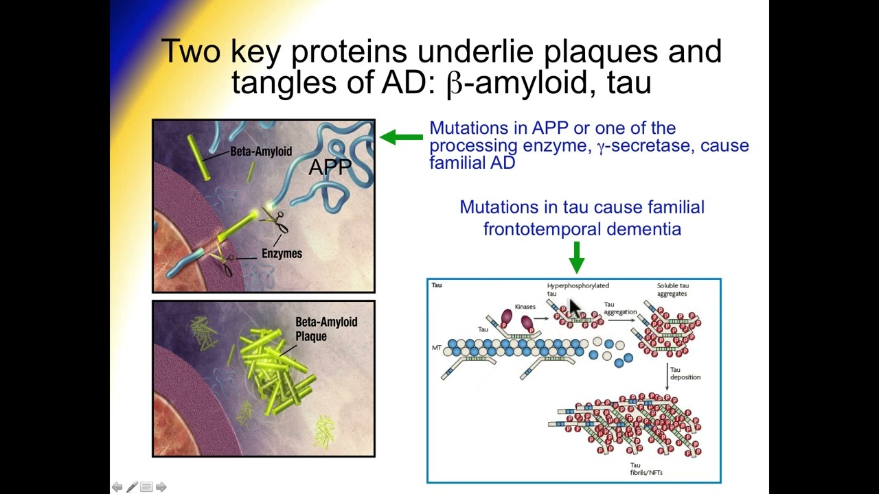 Alzheimer's Disease - The amyloid cascade, alternative mechanisms