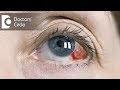 Causes of red clots in eyes - Dr. Mala Suresh