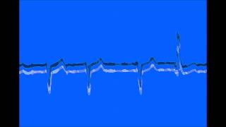 Graeme Revell - The Balli