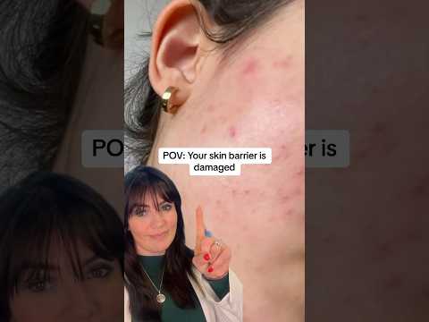 Do you have a damaged skin barrier? Follow these tips to repair and rebuild it 👆🏽 #skincaretips