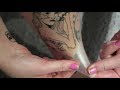 Tattoo aftercare & how to remove Saniderm