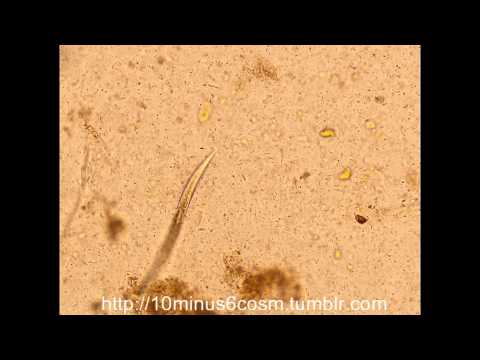 Pinworms gv kezeléssel