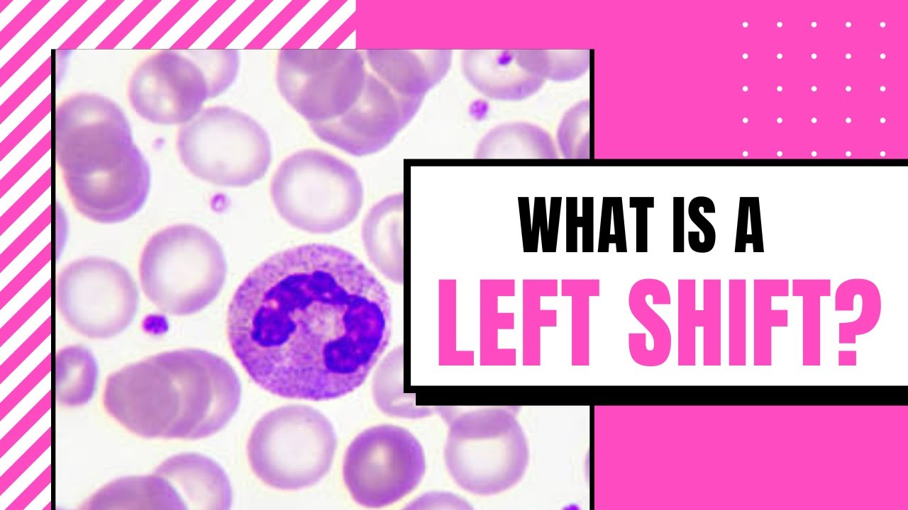 What’s a left shift CBC? Archive REF