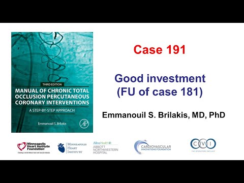 Case 191: Manual of CTO PCI - Good investment!