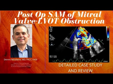 Post Operative SAM and LVOT Obstruction Following Mitral Valve Repair - A Case Study.