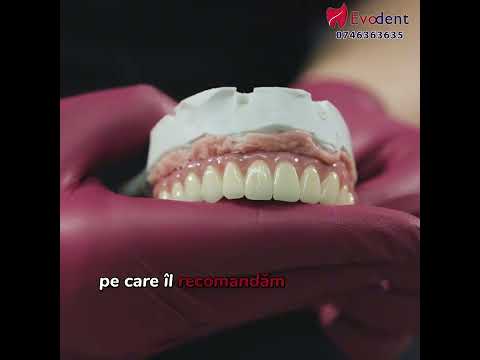 Cât costă să-ți recapeți zâmbetul cu implanturi dentare fixe?