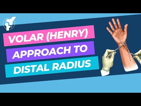 OrthoApproach - Volar (Henry) Approach to Distal Radius | Surgical Demonstration