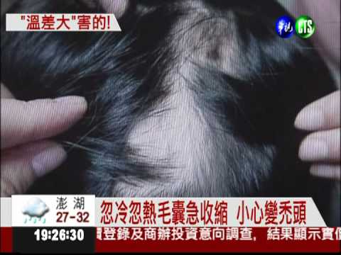 溫差太大猛掉髮 少年求診怕禿頭
