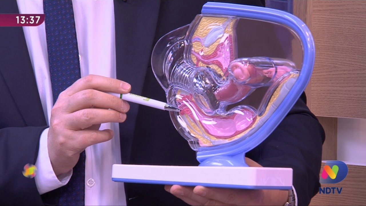 Saúde da Mulher Dr. Belarmino tira dúvidas sobre infecções