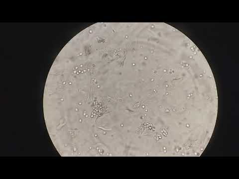Giardia parasite contagious