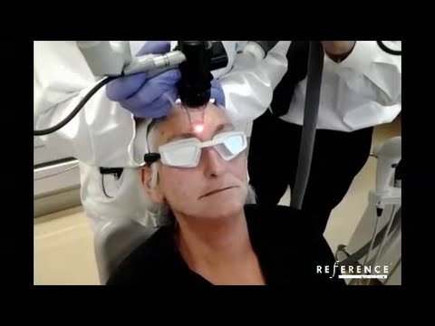 AcuPulse by Lumenis - Dr. Tretti Facial Resurfacing, Madrid 2014