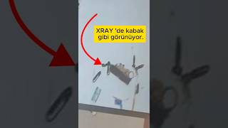Güvenlik Görevlisi, Benim Çakıyı Görünce 😵‍💫