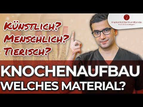 Knochenaufbau - Welches Material ist das Beste für mich? Eigenknochen oder Ersatzmaterial?