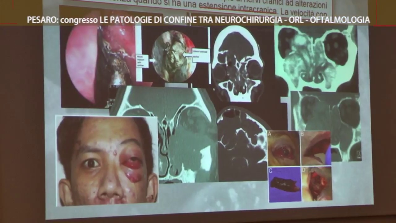 Letterio Morabito-15