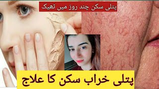 Thin skin treatment Face Redness Treatment at home | FORMULA CREAMS SIDE EFFECTS |