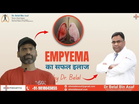 Empyema ka Safal Ilaaj | Patient Testimonial | Dr. Belal