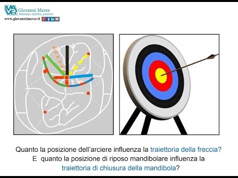 Appendere sulla barra a unernia del rachide cervicale Dolore nella parte destra della vita e laddome