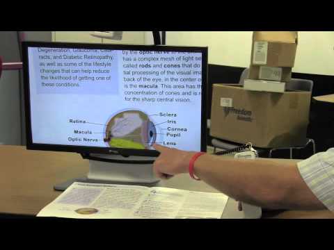 Onyx HD Video Magnifier