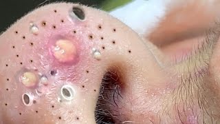 𝘚ℎ𝘢𝑟𝘦 𝘵𝑖𝘱𝑠 𝑓𝘰𝑟 𝑐𝘭𝑒𝘢𝑛𝘪𝑛𝘨 𝘢𝑛𝘥 𝘵𝑎𝘬𝑖𝘯𝑔 𝑐𝘢𝑟𝘦 𝘰𝑓 𝑦𝘰𝑢𝘳 𝘧𝑎𝘤𝑒 #35