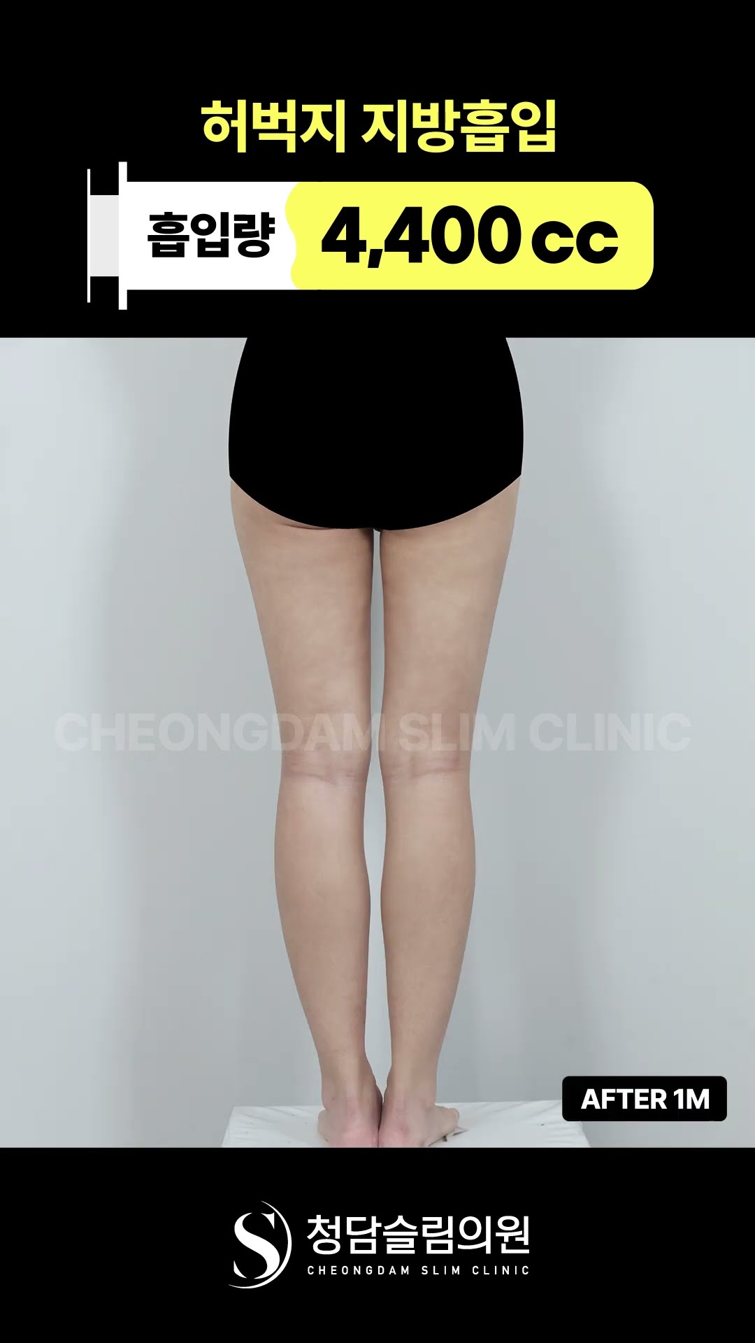 운동 안하고 바지 사이즈 줄이는 방법