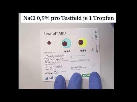 Экспресс тесты для подтверждения совместимости донор-реципиент перед переливанием крови - фото 1 - id-p2829630510