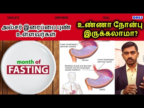 அல்சர் இருப்பவர்கள் நோன்பு,உபவாசம்,விரதம் இருக்கலாமா? Can ULCER Patient Take  FASTING l #DrSj_ULCER Video