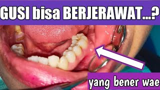Download lagu JERAWAT di GUSI?? Emang Bener Ada mp3 Download lagu JERAWAT di GUSI?? Emang Bener Ada mp3