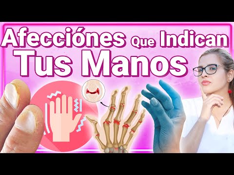 7 Diseases Your Hands Indicate and How to Reverse Them