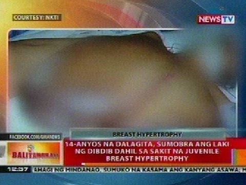 Cream para sa dibdib pagpapalaki aliekspress review Kung ito ay posible pagkatapos ng dibdib plastic breastfeed