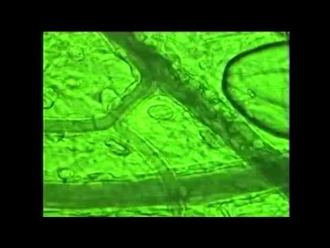 BEMER Group   The BEMER therapie principle English online video cutter com