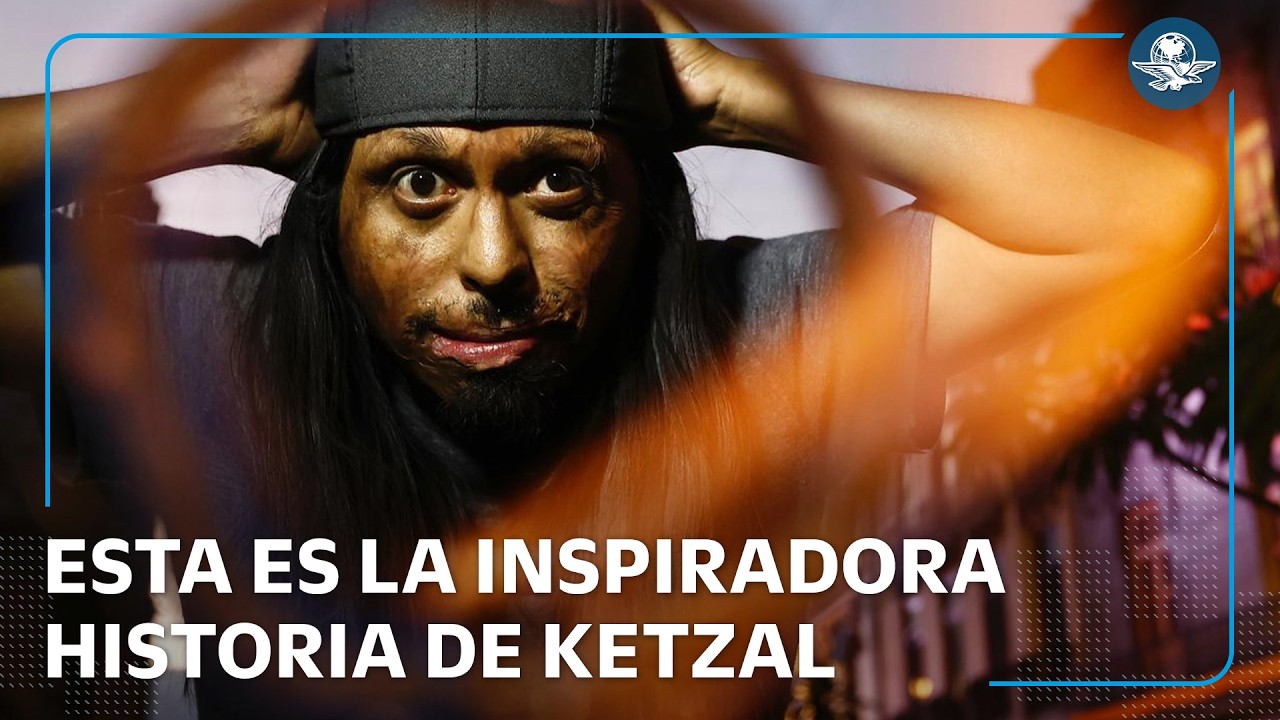 Ketzal Reyes: del accidente que lo marcó al stand up y mensaje de resiliencia