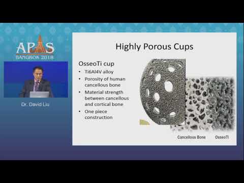Acetabular Reconstruction Options in Revision THA - Dr. David Liu