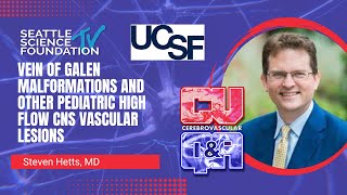 Vein of Galen Malformations and Other Pediatric High Flow CNS Vascular Lesions – Steven Hetts, MD