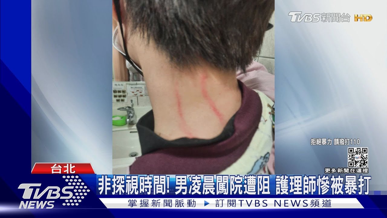 非探視時間!男凌晨闖院遭阻 護理師慘被暴打