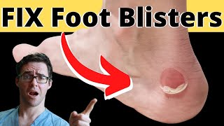 How to Treat a Foot Blister, Toe Blister or Heel Blister [POP IT???]