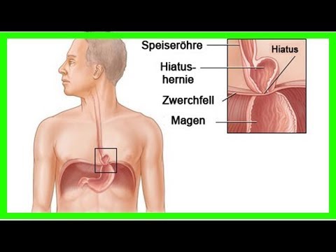 Langetki für Knie Schmerzen im Steißbein zurück Frau Ursachen
