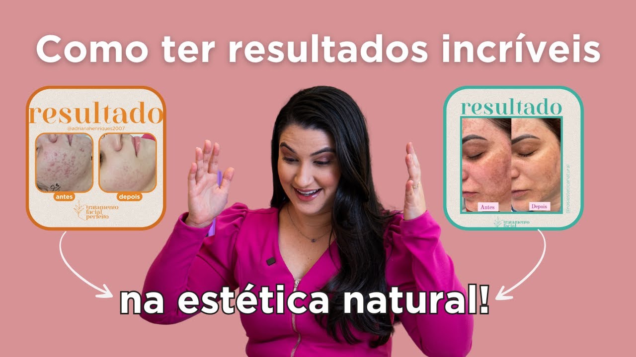 4 chaves para ter resultados incríveis na Estética Natural!