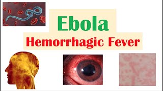 Overview of Ebola | Hemorrhagic Fever, Causes, Pathophysiology, Symptoms, Diagnosis, Treatment