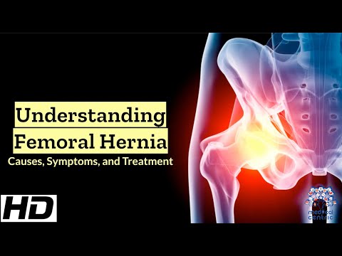 Frozen Shoulder Causes Signs and Symptoms Diagnosis and Treatment