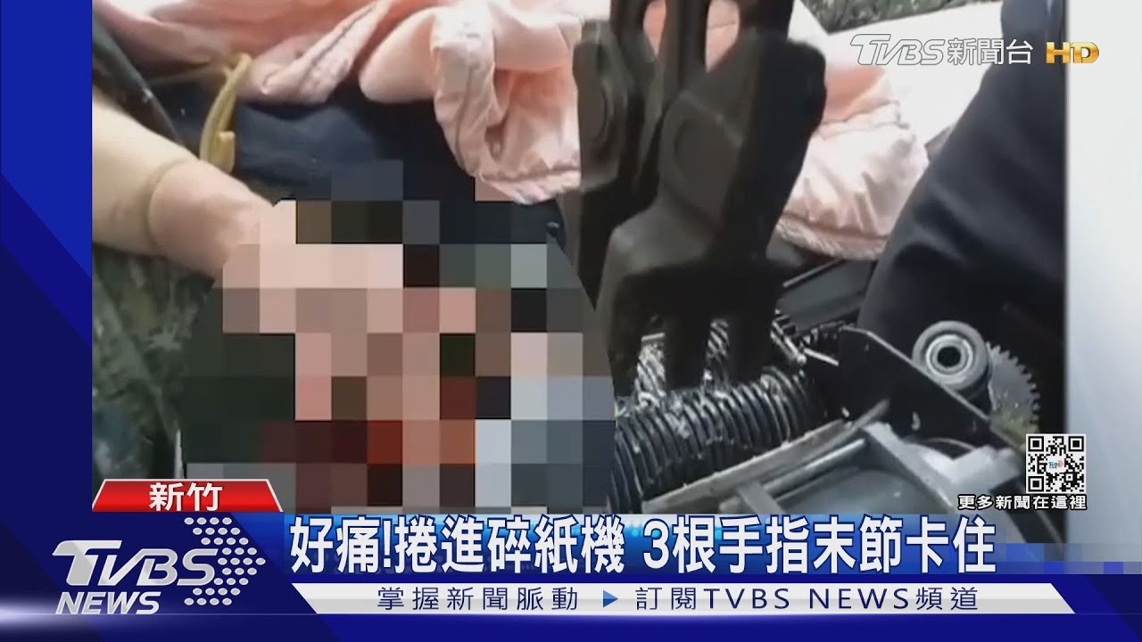 好痛!捲進碎紙機 3根手指末節卡住