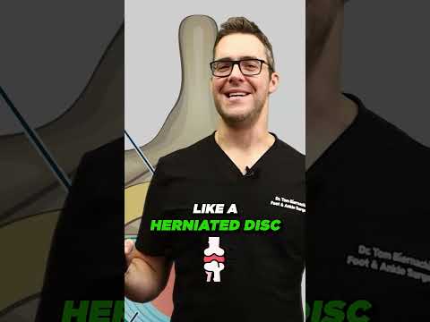 How to Cure Plantar Fasciitis in One Week Treatment Therapies